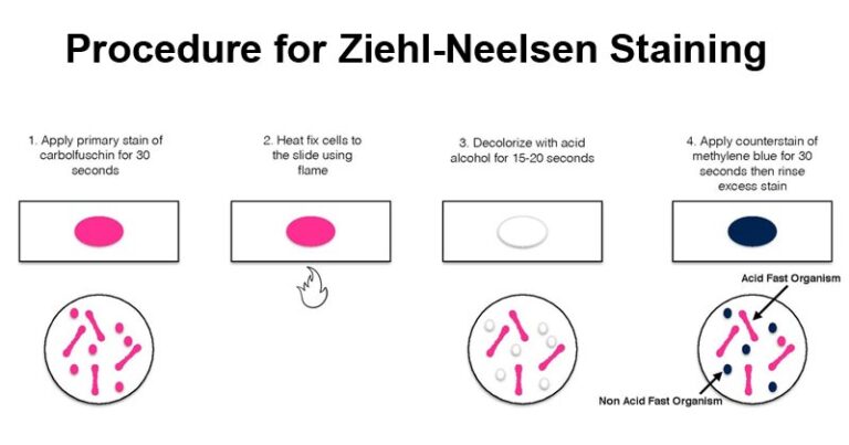 Zn Staining Procedure Principle Method And Results Rbr Life Science